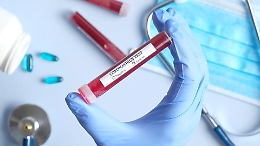 Indagine di siero prevalenza coronavirus in Sicilia, ecco i 120 Comuni interessati