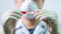 Coronavirus in Sicilia, altri 21 positivi
Nove sono a Ragusa (ma solo 5 migranti)