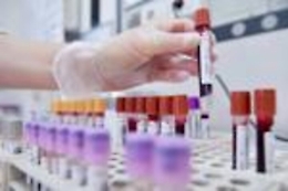 Appello ai donatori in estate