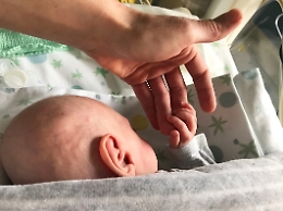 Neonata prematura di 24 settimane operata (e salvata) all'ospedale di Patti