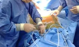 Solidariet&agrave; che salva vite: due donazioni multiorgano in una settimana all'ospedale Umberto I di Siracusa
