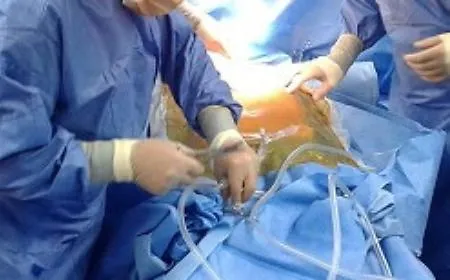 Solidariet&agrave; che salva vite: due donazioni multiorgano in una settimana all'ospedale Umberto I di Siracusa