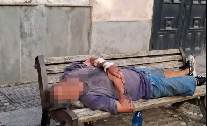 Pietro Puzone, l&rsquo;ex calciatore del Napoli e del Catania soccorso dopo giorni su una panchina